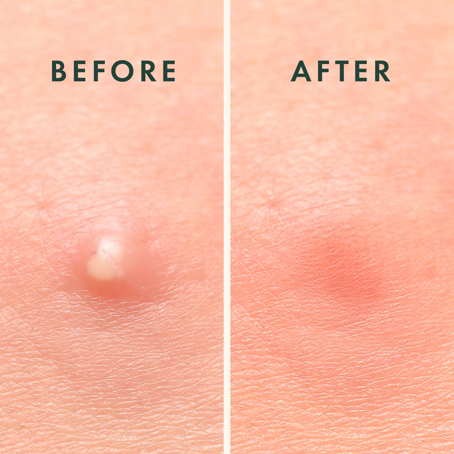 Rael Miracle Patch Spot Cover Bundle, 6 Pack