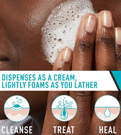 CeraVe Acne Foaming Cream Cleanser, 5 fl. oz.